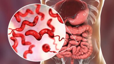 بیماری های مشترک بین انسان و حیوان خانگی 2 بیماری های مشترک بین انسان و حیوان خانگی