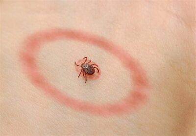 بیماری های مشترک بین انسان و حیوان خانگی 7 بیماری های مشترک بین انسان و حیوان خانگی